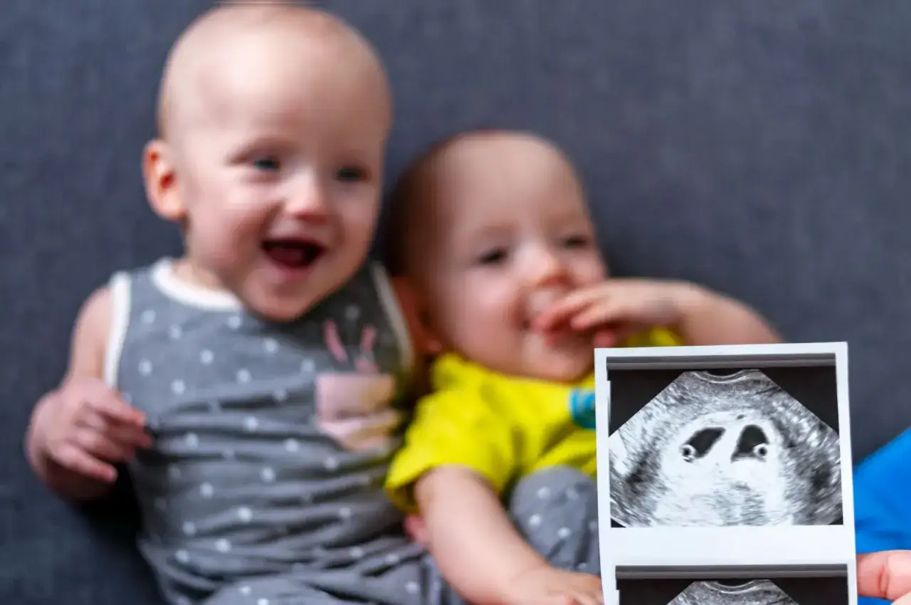 Uśmiechnięte bliźnięta na zdjęciu, a przed nimi USG z dwoma maluchami.