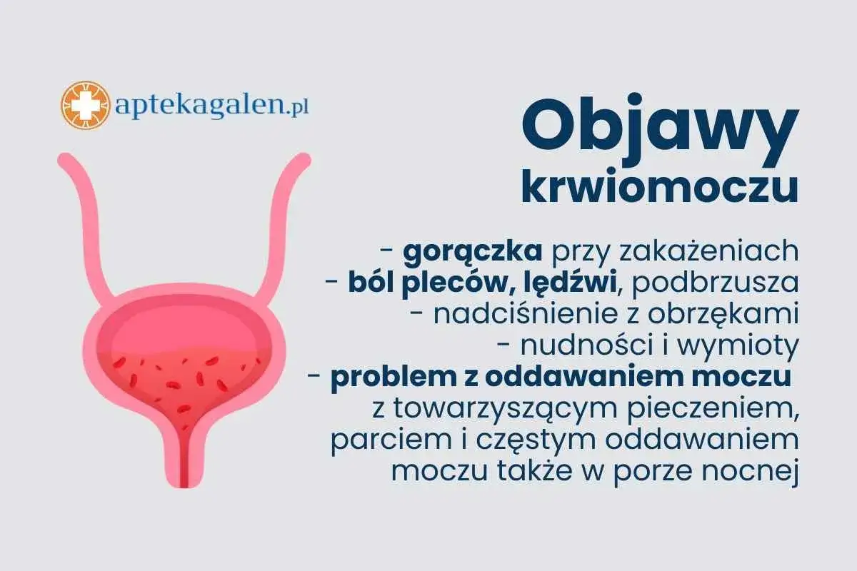 Objawy krwiomoczu u dziecka: gorączka, ból pleców, nudności, problem z oddawaniem moczu.
